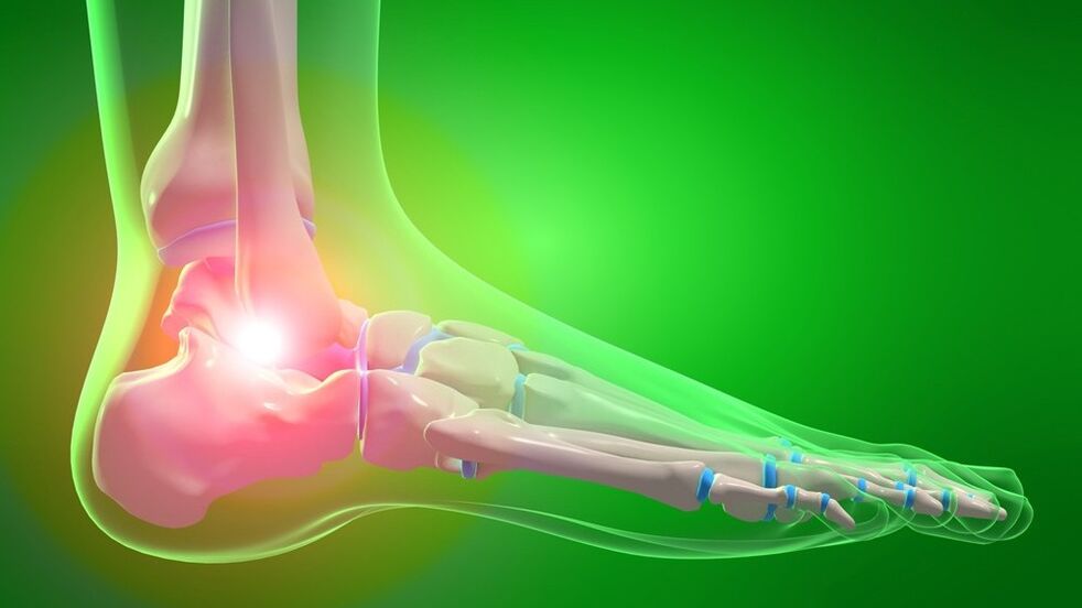artrosis de la articulación del tobillo