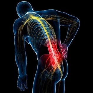 causas del dolor de espalda