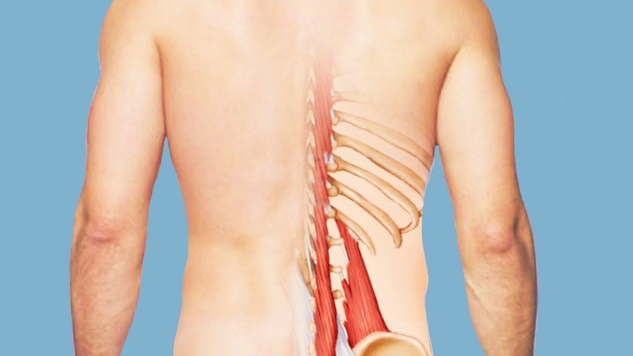 miositis como causa de dolor de espalda