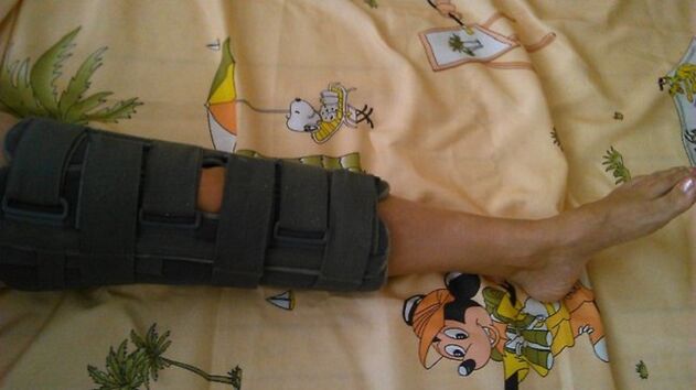 inmovilización de la articulación de la rodilla por dolor